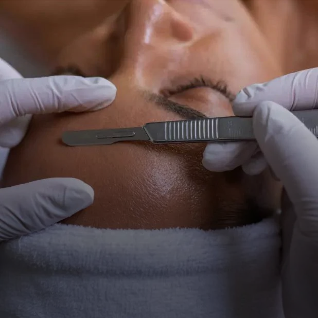 Dermaplaning